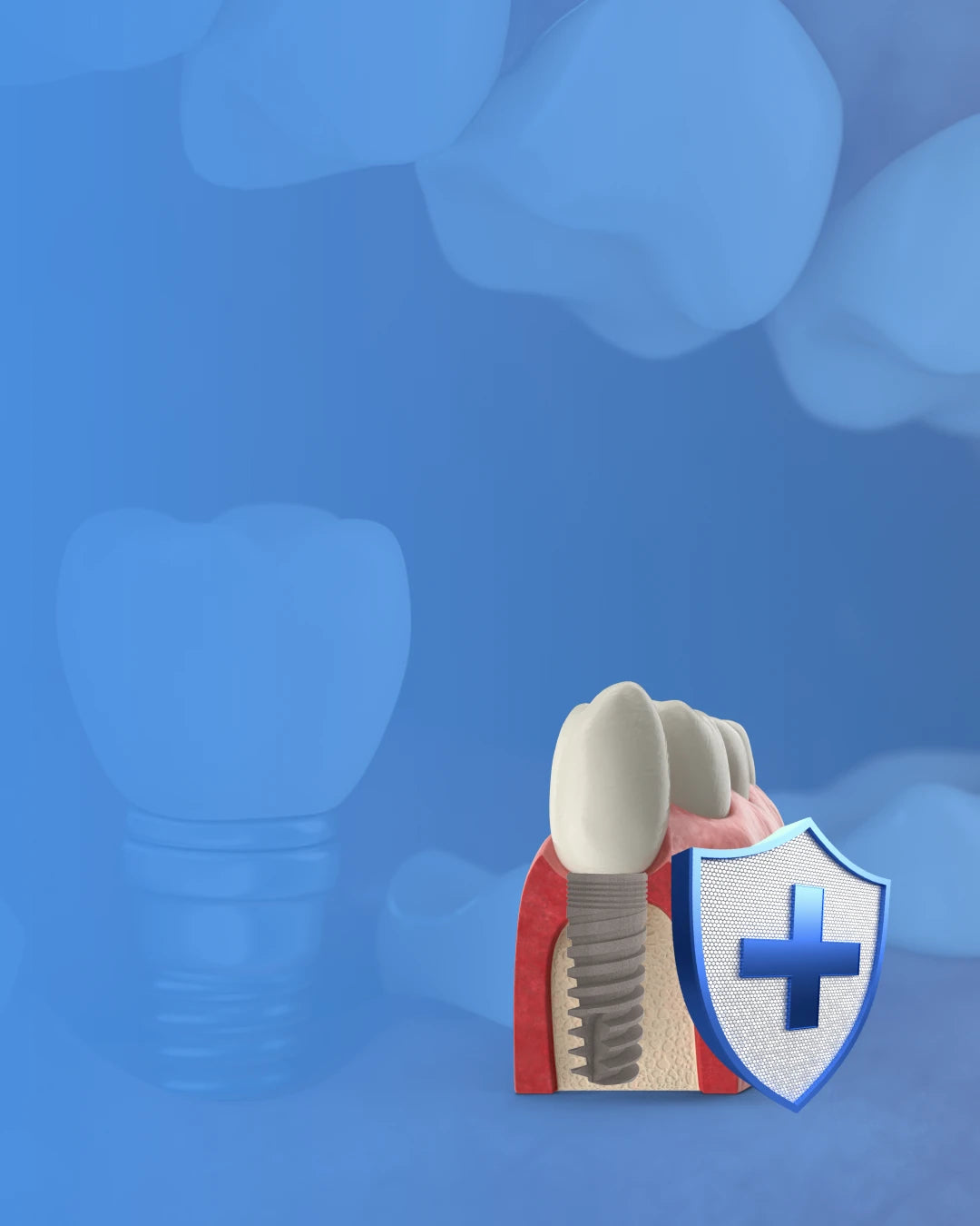 3D illustration of a dental implant with a protective medical shield icon on a blue background, representing GDT Supply USA lifetime warranty on dental implants.